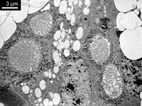 Acinus labiální žlázy neotenické samice termita (Prorhinotermes simplex), TEM