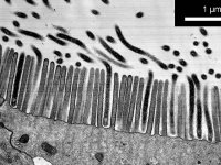 Bakterie mimikující střevní mikrovillus u termití mezikasty dělník-voják (Prorhinotermes simplex), TEM