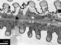 Porovnání trachey (nahoře) a vývodu labiální žlázy (dole) u neotenického termitího krále (Prorhinotermes simplex), TEM