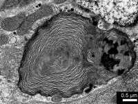 Masa myelinu v parietální buňce labiální žlázy u termitího vojáka (Prorhinotermes simplex), TEM