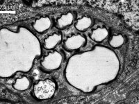 Group of tracheae in male imago termite (Prorhinotermes simplex), TEM